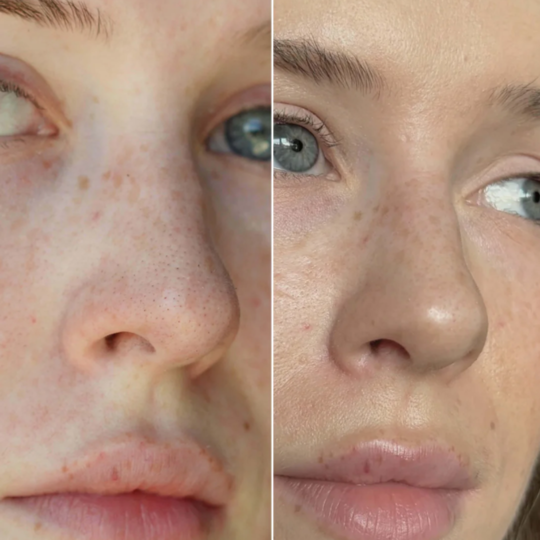 Luniva Pore Purifier – Verkleinert Nasenporen und absorbiert überschüssigen Talg. AKTION: 2 Packungen kaufen = 1 gratis dazu!