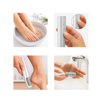 Amira SmoothFeet – Schmerzfreie Hornhautentfernung für weiche, selbstbewusste Schritte
